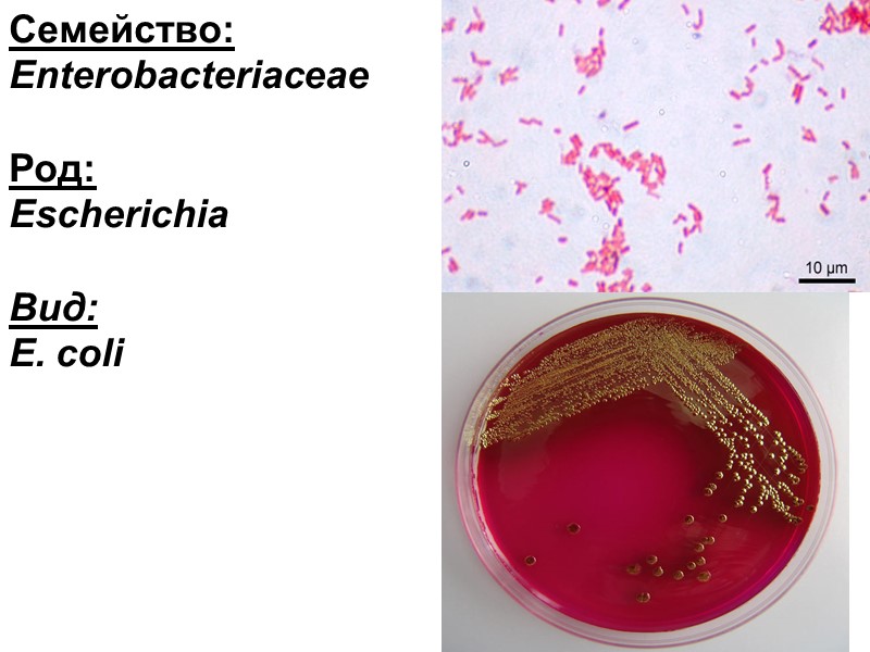Семейство: Enterobacteriaceae  Род:  Escherichia  Вид: E. coli